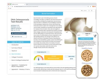 Osteoporosis Risk DNA Test