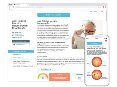 Age-Related Macular Degeneration