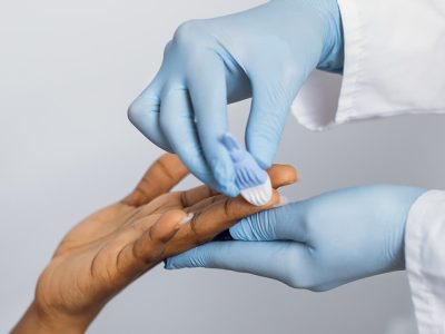 STD+HIV Test